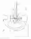 Fig. 02 - Radiation shielding apparatuses and applications thereof
