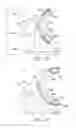 Fig. 11 - Transformable imaging system