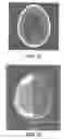 Fig. 23 - Portable medical imaging system with beam scanning collimator