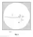 Fig. 07 - Computed tomography enhanced fluoroscopic system, device, and method of utilizing the same