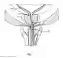 Fig. 08 - SHEATH ASSEMBLY FOR A TRANSURETHRAL PROCEDURE