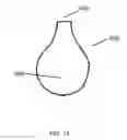 Fig. 15 - SHEATH ASSEMBLY FOR A TRANSURETHRAL PROCEDURE