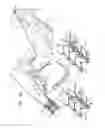 Fig. 05 - Post-implantation tension adjustment in cardiac implants