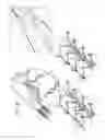 Fig. 07 - Post-implantation tension adjustment in cardiac implants