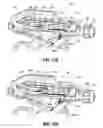 Fig. 100 - FLEXIBLE ENDOSCOPIC STITCHING DEVICES