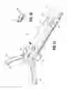 Fig. 34 - FLEXIBLE ENDOSCOPIC STITCHING DEVICES