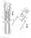 Fig. 36 - FLEXIBLE ENDOSCOPIC STITCHING DEVICES