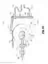 Fig. 45 - FLEXIBLE ENDOSCOPIC STITCHING DEVICES
