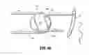Fig. 47 - FLEXIBLE ENDOSCOPIC STITCHING DEVICES