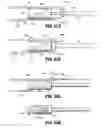 Fig. 48 - FLEXIBLE ENDOSCOPIC STITCHING DEVICES