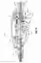 Fig. 52 - FLEXIBLE ENDOSCOPIC STITCHING DEVICES