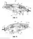 Fig. 53 - FLEXIBLE ENDOSCOPIC STITCHING DEVICES