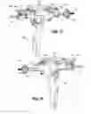 Fig. 55 - FLEXIBLE ENDOSCOPIC STITCHING DEVICES