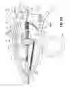 Fig. 72 - FLEXIBLE ENDOSCOPIC STITCHING DEVICES