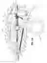 Fig. 76 - FLEXIBLE ENDOSCOPIC STITCHING DEVICES