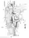 Fig. 78 - FLEXIBLE ENDOSCOPIC STITCHING DEVICES