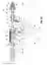 Fig. 85 - FLEXIBLE ENDOSCOPIC STITCHING DEVICES