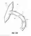 Fig. 88 - FLEXIBLE ENDOSCOPIC STITCHING DEVICES