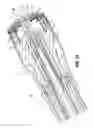 Fig. 13 - Anvil assemblies and delivery systems