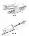 Fig. 16 - Anvil assemblies and delivery systems