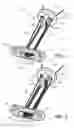 Fig. 02 - Knotless orthopedic stabilization system