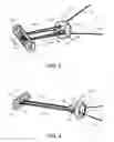 Fig. 03 - Knotless orthopedic stabilization system
