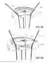 Fig. 06 - Knotless orthopedic stabilization system
