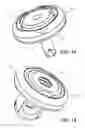 Fig. 12 - Knotless orthopedic stabilization system