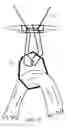 Fig. 14 - Knotless orthopedic stabilization system