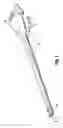 Fig. 04 - Dynamically matching input and output shaft speeds of articulating adapter assemblies for surgical instruments