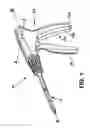 Fig. 02 - Multi-clip applier