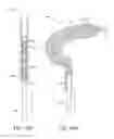 Fig. 28 - Vaso-occlusive devices including a friction element