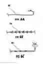 Fig. 07 - Specimen retrieval device including an integrated sliding grasper