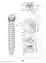 Fig. 02 - Orthopedic fixation devices and methods of installation thereof
