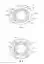 Fig. 06 - Orthopedic fixation devices and methods of installation thereof