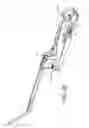 Fig. 22 - Pedicle screw extension for use in percutaneous spinal fixation