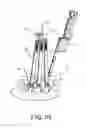 Fig. 33 - Pedicle screw extension for use in percutaneous spinal fixation