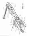 Fig. 43 - Pedicle screw extension for use in percutaneous spinal fixation