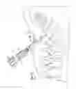 Fig. 09 - Spinal fixation tool set and method