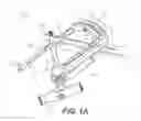 Fig. 02 - Systems and methods for intramedullary nail implantation