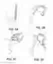 Fig. 06 - Systems and methods for intramedullary nail implantation