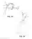 Fig. 07 - Systems and methods for intramedullary nail implantation