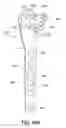 Fig. 46 - Systems and methods for using polyaxial plates