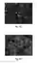 Fig. 06 - Methods and devices for selective disruption of visceral fat by controlled cooling