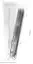 Fig. 02 - Extendable electrosurgical apparatus and method