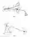 Fig. 02 - Electrosurgical end effector assemblies and electrosurgical forceps configured to reduce thermal spread