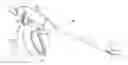 Fig. 01 - Electrosurgical devices including transverse electrode configurations