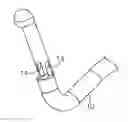Fig. 01 - Method and device for uterine fibroid treatment