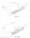 Fig. 06 - Method and device for uterine fibroid treatment