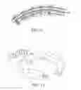 Fig. 09 - Methods, systems, and devices for surgical access and procedures